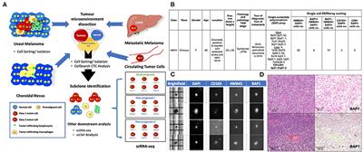 Applying Single-Cell Technology in Uveal Melanomas: Current Trends and Perspectives for Improving Uveal Melanoma Metastasis Surveillance and Tumor Profiling